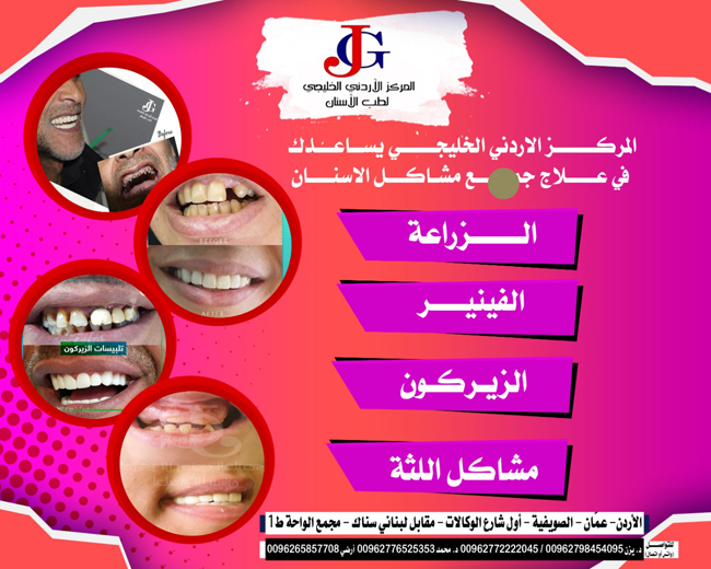 المركز الأردني الخليجي لطب الأسنان يرحب بكم P_141691bnw1